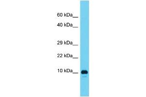 Host: Rabbit  Target Name: RGD1561459  Sample Tissue: Rat Testis lysates  Antibody Dilution: 1.