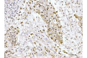 IHC analysis of GP210/NUP210 using anti-GP210/NUP210 antibody (ABIN7600707).