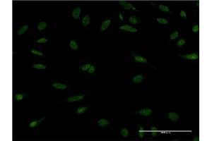 Immunofluorescence of monoclonal antibody to PPM1A on HeLa cell. (PPM1A antibody  (AA 1-382))
