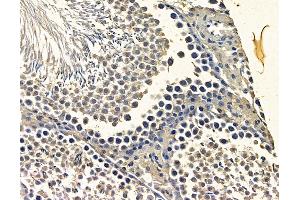 ABIN7096864 and ABIN7100930 at 1/100 staining rat testis tissue by IHC-P. (NAA25 antibody)