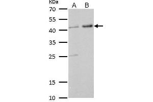 WB Image GNAS antibody [C2C3-2], C-term detects GNAS protein by Western blot analysis.
