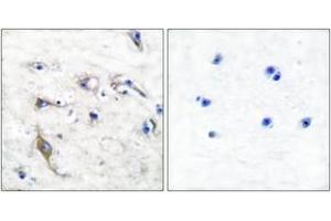 Immunohistochemistry analysis of paraffin-embedded human brain tissue, using JM4 Antibody.