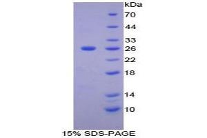 SDS-PAGE analysis of Human Matrix Metalloproteinase 11 (MMP11) Protein.