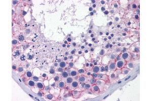 Immunohistochemistry (IHC) image for anti-Tight Junction Protein 1 (TJP1) (Middle Region) antibody (ABIN2774876) (TJP1 antibody  (Middle Region))