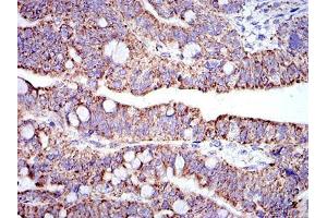 Immunohistochemistry (IHC) image for anti-Prohibitin (PHB) antibody (ABIN969353)