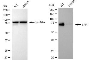 Western blotting analysis using LPP antibody (ABIN7799277).