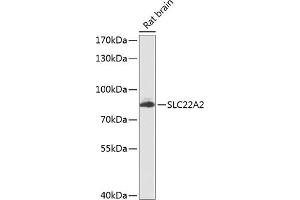 Western blot analysis of extracts of rat brain, using SLC22 antibody (ABIN6129480, ABIN6147887, ABIN6147889 and ABIN6224517) at 1:1000 dilution. (SLC22A2 antibody  (AA 44-140))