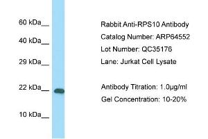 Western Blotting (WB) image for anti-Ribosomal Protein S10 (RPS10) (C-Term) antibody (ABIN2789874) (RPS10 antibody  (C-Term))