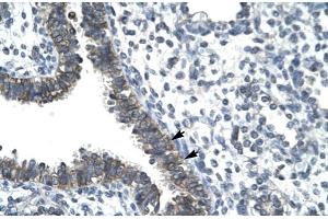 Human Lung (CCRN4L antibody  (N-Term))