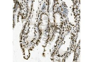IHC analysis of PRDM5 using anti-PRDM5 antibody (ABIN7600853).