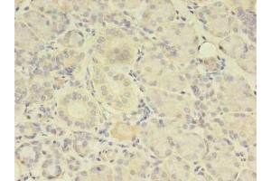 Immunohistochemistry of paraffin-embedded human pancreatic tissue using ABIN7173738 at dilution of 1:100 (TBCA antibody  (AA 2-108))