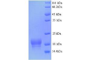 SDS-PAGE (SDS) image for Fragile Histidine Triad (FHIT) (AA 2-150) protein (His tag) (ABIN4976799) (FHIT Protein (AA 2-150) (His tag))