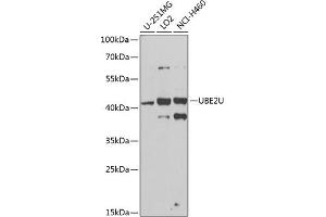 Western blot analysis of extracts of various cell lines, using UBE2U antibody (ABIN6130858, ABIN6149825, ABIN6149826 and ABIN6224418) at 1:1000 dilution. (UBE2U antibody  (AA 1-226))