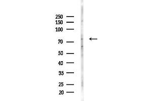 Western blot analysis of lysates from HepG2 cells(heat-shock,45 min treatment), using PRPF39 Antibody at 1/1000 dilution.