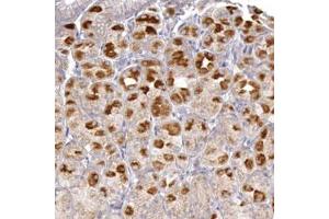 Immunohistochemical staining (Formalin-fixed paraffin-embedded sections) of human stomach tissue with PIK3R1 polyclonal antibody  at 1:50 - 1:200 dilution. (PIK3R1 antibody  (AA 182-328))