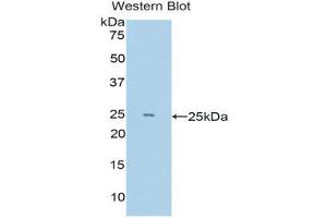 Western Blotting (WB) image for anti-Lysine (K)-Specific Demethylase 4C (KDM4C) (AA 685-871) antibody (ABIN1176553) (KDM4C antibody  (AA 685-871))