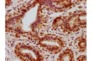 Immunohistochemistry (IHC) image for anti-cAMP Responsive Element Binding Protein 1 (CREB1) (pSer133) antibody (ABIN7127685)