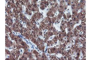 Immunohistochemistry (IHC) image for anti-Cytochrome P450, Family 2, Subfamily A, Polypeptide 6 (CYP2A6) antibody (ABIN1497724) (CYP2A6 antibody)