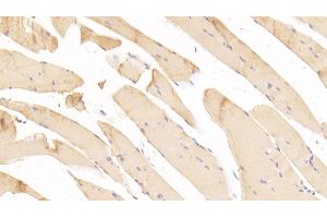 Detection of PAP in Mouse Skeletal muscle Tissue using Polyclonal Antibody to Prostatic Acid Phosphatase (PAP) (ACPP antibody  (AA 56-215))