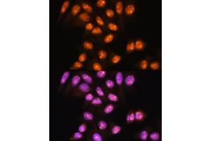 Immunofluorescence analysis of HeLa cells using YY2 Rabbit pAb (ABIN7271429) at dilution of 1:100.