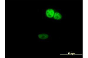 Immunofluorescence of purified MaxPab antibody to ZNF124 on HeLa cell. (ZNF124 antibody  (AA 1-289))