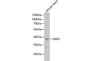 Western blot analysis of extracts of mouse heart, using LIMS1 antibody (ABIN6132048, ABIN6143232, ABIN6143234 and ABIN6218088) at 1:1000 dilution.