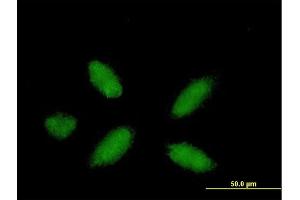 Immunofluorescence of purified MaxPab antibody to PPARA on HepG2 cell. (PPARA antibody  (AA 1-468))