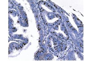 IHC analysis of Ki67 using anti-Ki67 antibody (ABIN7601101).