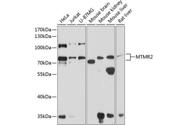 MTMR2 antibody  (AA 404-643)