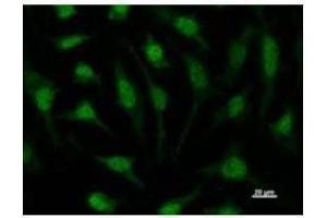 Immunostaining analysis in HeLa cells. (RUVBL1 antibody)