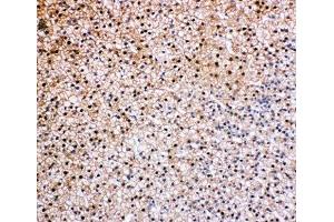 IHC-P: VCP antibody testing of rat epinephros tissue (VCP antibody  (C-Term))