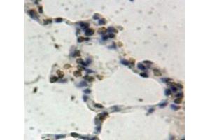 IHC-P analysis of Lung tissue, with DAB staining. (SIRT1 antibody  (AA 244-498))