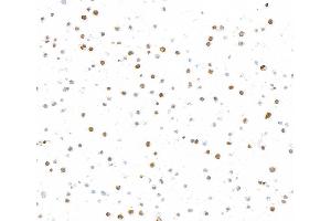 Immunocytochemistry (ICC) image for anti-Topo IIalpha (AA 650-700) antibody (ABIN7795795) (Recombinant Topo IIalpha (AA 650-700) antibody)