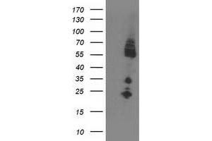 HEK293T cells were transfected with the pCMV6-ENTRY control (Left lane) or pCMV6-ENTRY IRF6 (Right lane) cDNA for 48 hrs and lysed. (IRF6 antibody)