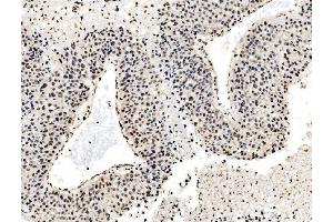 IHC analysis of DBC-1/CCAR2 using anti-DBC-1/CCAR2 antibody (ABIN7602235). (CCAR2 antibody  (AA 65-917))