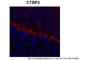 Sample Type: outer mouse plexiform layerRed: PrimaryBlue: DAPIPrimary Dilution: 1:200Secondary Antibody: Goat anti-Rabbit AF568 IgG(H+L)Secondary Dilution: 1:200Image Submitted by: David ZenisekYale University (CTBP2 antibody  (Middle Region))