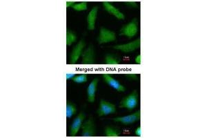 ICC/IF Image Immunofluorescence analysis of paraformaldehyde-fixed HeLa, using 20S Proteasome alpha 6, antibody at 1:200 dilution. (PSMA6 antibody  (Center))