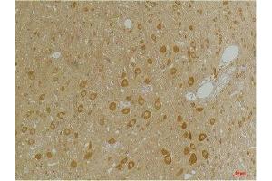Immunohistochemical analysis of paraffin-embedded Rat BrainTissue using GABA A Receptor α3 Rabbit pAb diluted at 1:200. (GABRA3 antibody)