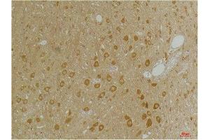Immunohistochemical analysis of paraffin-embedded Rat BrainTissue using GABA A Receptor α3 Rabbit pAb diluted at 1:200.
