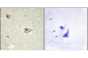 Immunohistochemistry analysis of paraffin-embedded human brain tissue, using Cytochrome P450 19A1 Antibody. (Aromatase antibody  (AA 221-270))