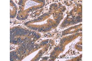 Immunohistochemistry of Human brain  using S100A13 Polyclonal Antibody at dilution of 1:40 (S100A13 antibody)