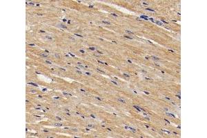 Immunohistochemistry analysis of paraffin-embedded mouse heart using,TMP1 (ABIN7076030) at dilution of 1: 1600 (Tropomyosin antibody)