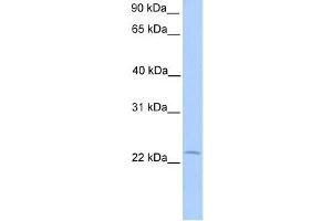 Human Placenta; WB Suggested Anti-C5orf39 Antibody Titration: 0. (Chromosome 5 Open Reading Frame 39 (C5orf39) (N-Term) antibody)