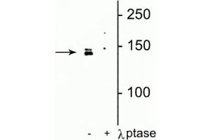 Western blot of HeLa cell lysate showing specific immunolabeling of the ~142 kDa DENND3 protein phosphorylated at Ser554 in the first lane (-). (DENND3 antibody  (pSer554))