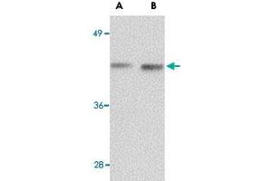 Western blot analysis of NANOS1 in rat brain tissue lysate with NANOS1 polyclonal antibody  at (A) 1 and (B) 2 ug/mL .