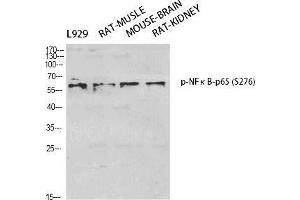 Western Blot (WB) analysis of specific cells using Phospho-NFkappaB-p65 (S276) Polyclonal Antibody. (NF-kB p65 antibody  (pSer276))