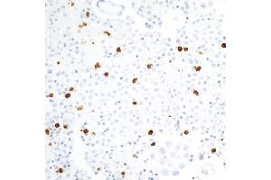 Immunohistochemistry (IHC) image for anti-Carcinoembryonic Antigen-Related Cell Adhesion Molecule 8 (CEACAM8) (AA 23-320) antibody (ABIN7453895)