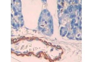 Figure. (LRP3 antibody  (AA 184-435))