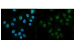 IF analysis of CBS using anti-CBS antibody (ABIN7599637). (CBS antibody  (AA 102-342))