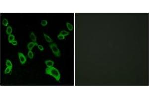 Immunofluorescence analysis of LOVO cells, using GPR139 Antibody. (GPR139 antibody  (AA 181-230))